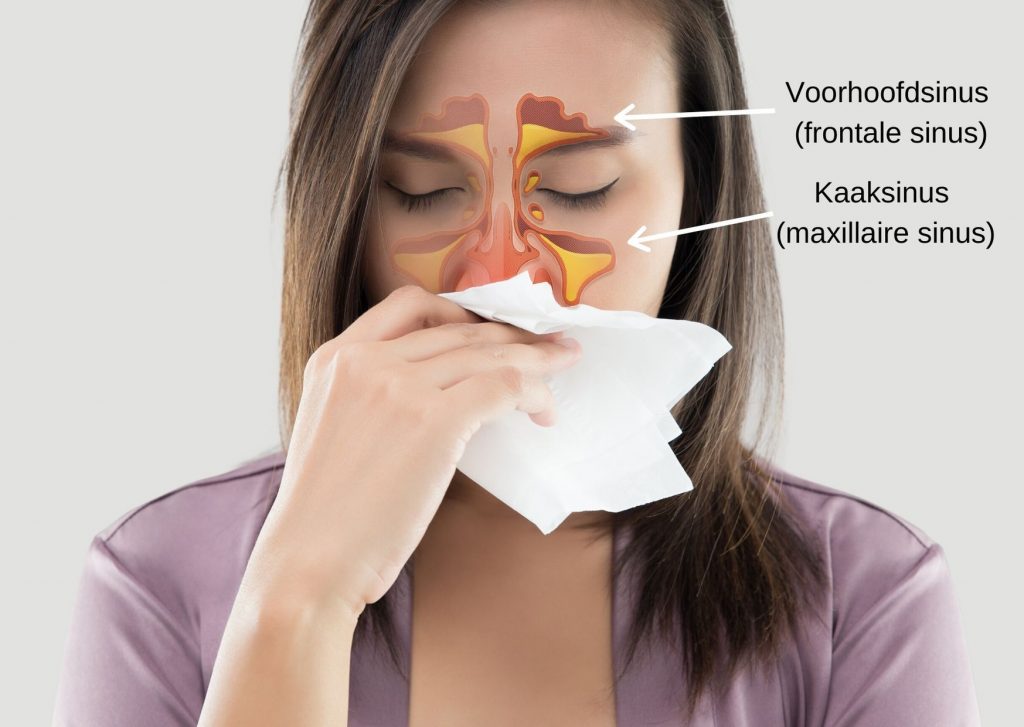chronische sinusitis vermoeidheid