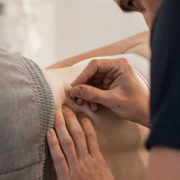 Wat is dry needling?